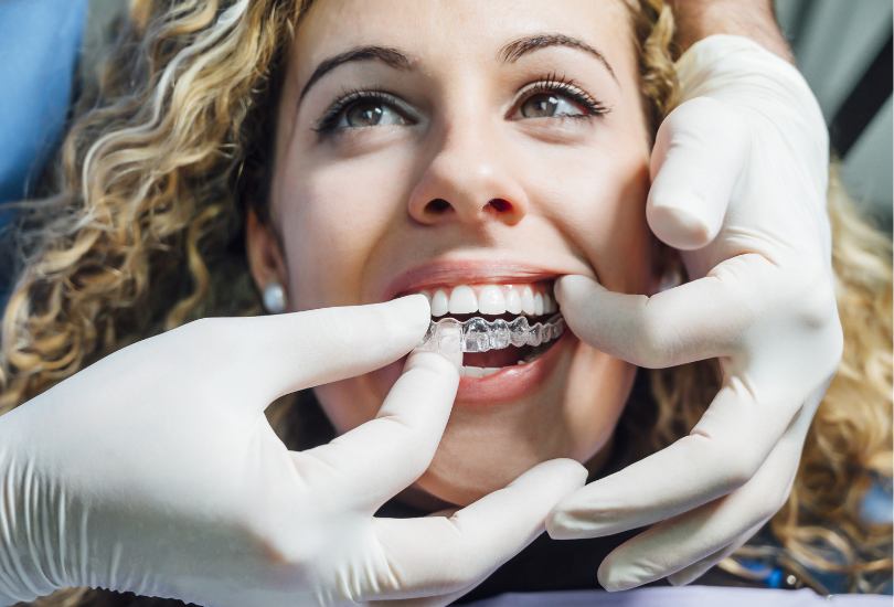 Invisible Orthodontics - Implantcenter dentistry UK
